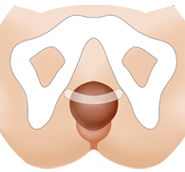 ¹Ì´Ï½½¸µ¼ö¼ú